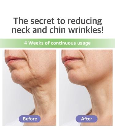 Labottach Double Chin Reducer & Neck Wrinkle Patches - 4 pcs | Collagen, Ceramide & Hyaluronic Acid | Hydrating Firming Mask for Instant Face Lift - Korean Skincare - Buy Online on GoSupps.com