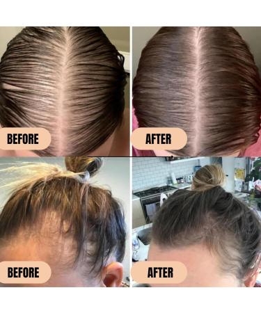 Batana Oil for Hair Growth | Thinning Hair Shampoo & Mask - 3-in-1 Set with Rosemary Rice Water Biotin & Clove Oil - Dr. Sebi - Buy Online on GoSupps.com