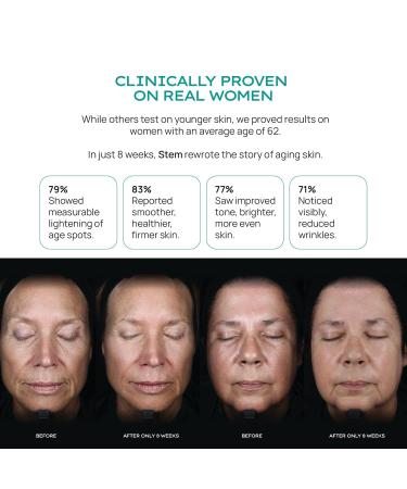 ReVive Ritual Skincare Bundle 3 Pack - ReNew ReGenerative and ReVitalize Luxury Face Moisturizer for Women Premium Facial Skin Care Products Overnight Face Mask & Cream 1oz each - Buy Online on GoSupps.com