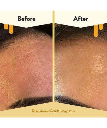 Eczema Honey Oatmeal Facial Cleanser - Gentle Daily Face Wash for Dry, Itchy, Sensitive Skin (6 Oz) - Buy Online on GoSupps.com