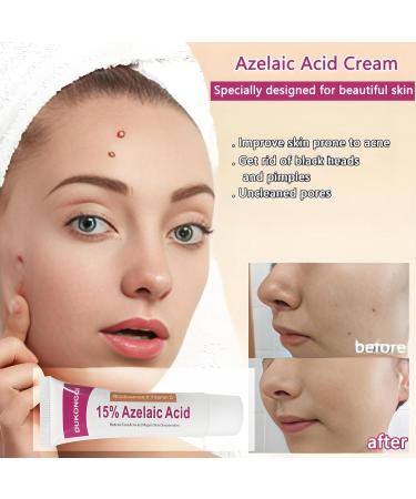 Azelaic acid cream Azelaic acid facial care essence face cream suitable for facial skin problems and beauty care relieve skin redness and acne(1pcs) 1 Fl Oz (Pack of 1) - Buy Online on GoSupps.com