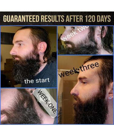 Voxtr Beard Growth Serum - Thicker & Healthier Beard with Follicle Acceleration - 1.69 Fl. Oz - International Shipping Available - Buy Online on GoSupps.com