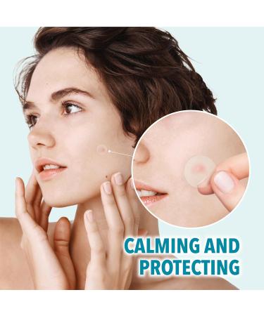 Micro Spot Care Patch - Self-Dissolving Acne Pimple Treatment | Target Zits & Blemishes with Patented 17mm Microdart Technology - Buy Online on GoSupps.com