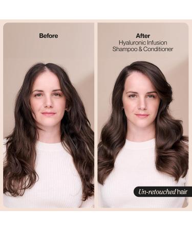 Suave Hyaluronic Infusion Moisturizing Conditioner 28 oz | Long Lasting Hydration for Dry Hair | Intense Hydration with Hyaluronic Acid | International Shipping Available - Buy Online on GoSupps.com