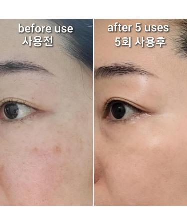 Hydrogen Dual Skin Changer Set | Hydrating Anti-Aging K-Beauty Therapy | International Shipping - Buy Online on GoSupps.com