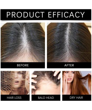 Apr s-shampoing PP405 essence anti-chute absorption rapide non gras unisexe huile de croissance capillaire sans rin age convient tous types de cheveux 1PCS - Buy Online on GoSupps.com