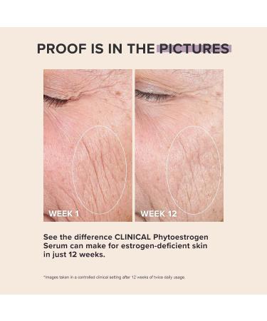 Paula's Choice CLINICAL Phytoestrogen Elasticity Renewal Face Serum 1 Fl Oz - Restores Loose, Thin, & Crepey Skin - Fragrance-free & Cruelty-free - Buy Online on GoSupps.com