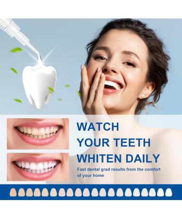 LUCKIN SMILE 10-Pack 44% Teeth Whitening Gel Refills 44% Carbamide Peroxide Gel Sensitive Teeth Whitening 3ML Whitening Gel Syringes for Teeth Whitening Kits Trays 60 Whitening Treatments - Buy Online on GoSupps.com