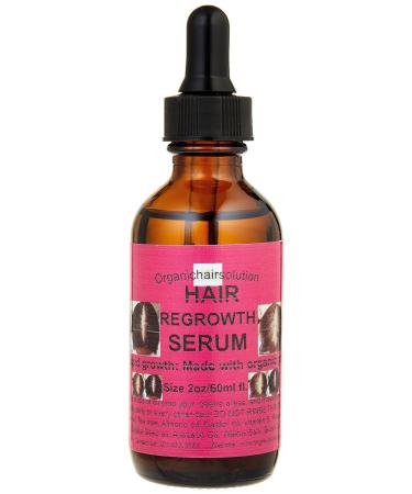 -Edge growth Serum- Scalp & Hair Oil-For Strengthening - Growth Thicker Longer Hair-for Split Ends &Dry Scalp Dandruff- WithPeppermint-Avocado-Castor-Amla- Argan (2oz)