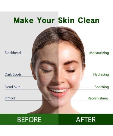 Purederm Vegan Aloe Face Sheet Masks (12 Packs) for Dry, Dehydrated, and Dull Skin - Hydrating, Moisturizing, Brightening, and Soothing Beauty Mask for All Skin Types - Aloe Vera 12 Pack - Buy Online on GoSupps.com