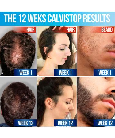 Hair Thickening Spray & Growth Supplement with Folic Acid - Regrowth Shampoo Serum & Capsules for Hair Loss Prevention (4oz Spray 60 Capsules) | Premium International Shipping - Buy Online on GoSupps.com