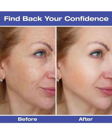 160 PC Forehead Wrinkle Patches for Face | Overnight Facial Wrinkle Remover Strips | Anti Wrinkle Patches for Eye, Mouth, Forehead | All-in-One Wrinkle Treatment - Buy Online on GoSupps.com