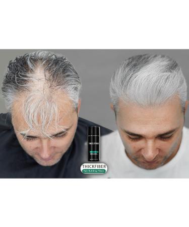 THICK FIBER Hair Building Fibres (Pack of 1 GREY) Hair Fibres for Thinning Hair | Hair Powder for Thinning Hair 25g Bottle | Make Hair Look Thicker in Seconds with hair filler | for Women & Men 25 g (Pack of 1) Grey - Buy Online on GoSupps.com