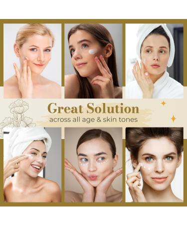 ABERA Melasma Cream (Premium Version) - Cream for Skin Care and Hydration Promoting Radiant and Healthy-Looking Skin Suitable for Sensitive Skin (1 Box + Gift) - Buy Online on GoSupps.com