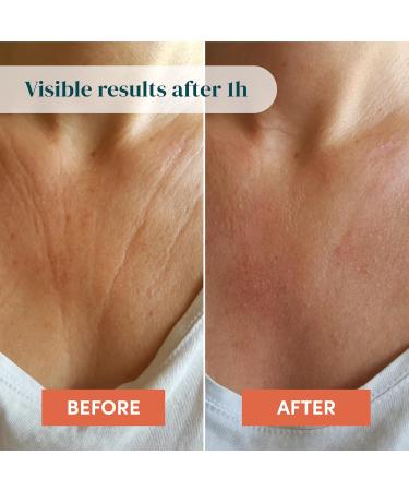 APRICOT Silicone Chest Wrinkle Pad with Hyaluronic Acid I 30x Reusable I Silicone Pad to Tighten Skin on D collet Area I Anti-Wrinkle Patch "libert d collet " Made in Germany Hyaluronic Acid 1 Count (Pack of 1) - Buy Online on GoSupps.com