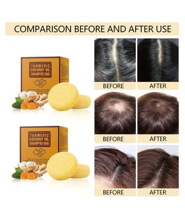 Tamoskiny Ginger & Turmeric Hair Regrowth Shampoo Bar - Organic Solid Bar for Hair Growth 120g - Buy Online on GoSupps.com