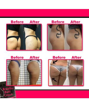 Brazilian Lift Cream for Cellulite - Firm & Lift Skin - 226ml/8oz - All Skin Types - Buy Online on GoSupps.com