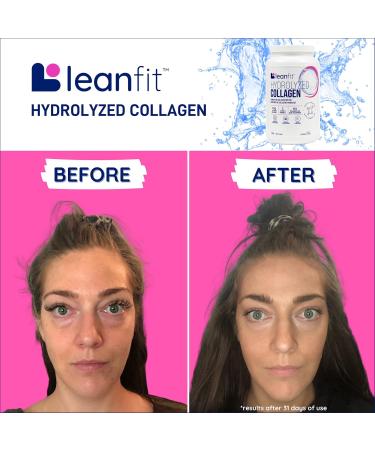 LEANFIT HYDROLYZED COLLAGEN Unflavoured 10g Grass-Fed Bovine Collagen (Type I III) + Vitamin C + Hyaluronic Acid Per Serving 98 Servings 1kg Tub for healthy skin hair bones joints & immunity 1 kg (Pack of 1) - Buy Online on GoSupps.com