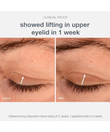 Dermalogica Phyto Nature Lifting Eye Cream - Best Eye Serum to Reduce Fine Lines & Wrinkles | International Shipping - Buy Online on GoSupps.com