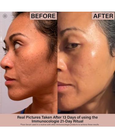 IMMUNOCOLOGIE Face Serum Oil- Dry Oil Serum That is Nourishing and Softening for Firmer More Supple Skin and All Over Radiance - 1 fl oz/30 ml - Buy Online on GoSupps.com