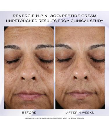 Lanco me R nergie H.C.F. Triple Serum Discovery Set - Buy Online on GoSupps.com