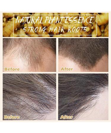 2 Pcs Organic Ginger Hair Growth Shampoo Bars for Hair Regrowth - Natural Ginger Soap for Stronger, Healthier Hair - Buy Online on GoSupps.com