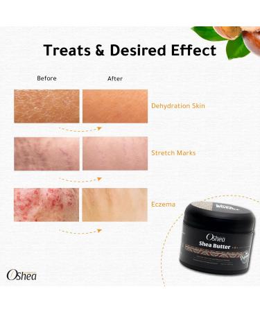 Organic Shea Butter 100% Pure & Unrefined Deep Moisturizer for Dry Skin Hair Lips & Baby Care All Natural Chemical-Free for all Skin Types (5 Fl Oz / 150 ML) 1.69 Fl Oz (Pack of 1) - Buy Online on GoSupps.com