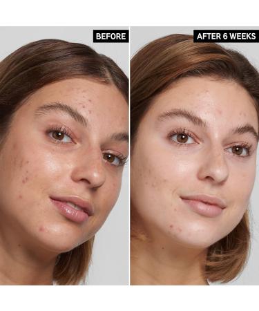 INKEY List 2% Salicylic Acid Cleanser 150ml for Oily Blemish Prone Skin - Buy Online on GoSupps.com