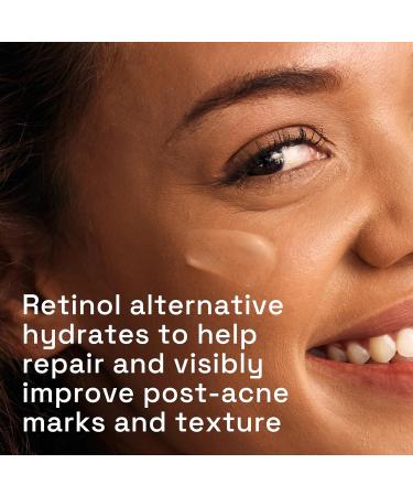 CETAPHIL Gentle Clear Repairing Serum | Retinol Alternative Oil-Free for Sensitive Skin | Bakuchiol & Acne Mark Treatment | 1 Fl Oz | Dermatologist Recommended - Buy Online on GoSupps.com