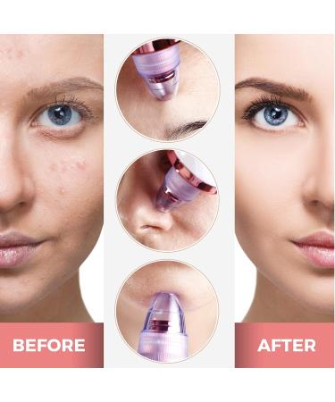 Valentine Beauty Blackhead Remover Pore Vacuum - Rechargeable Pore Extractor and Cleanser Tool with 5 Replaceable Suction Probes - Buy Online on GoSupps.com