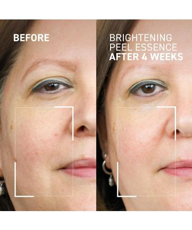 Dr. Brandt Dr. B Lab Brightening Peel Essence - Evens Skin Tone Smooths Skin Texture & Improves Radiance - 3.4 fl oz 3.4 Fl Oz (Pack of 1) - Buy Online on GoSupps.com