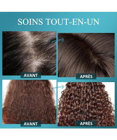 Gommage du Cuir Chevelu Biotine et Acide Salicylique Exfoliant Pour la Croissance Des Cheveux Cheveux Gras Tendance Pelliculaire et Cuir Chevelu Qui D mange Pr vention de la Chute Des Cheveux - Buy Online on GoSupps.com