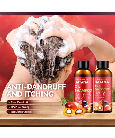 Batana l Shampoo und Conditioner Set Batana Haar Shampoo Set f r Haarwachstum Shampoo Conditioner f r Wiederherstellung besch digtes Haar d nnes Haar beseitigt Spliss 0.5 g (Lot de 2) - Buy Online on GoSupps.com