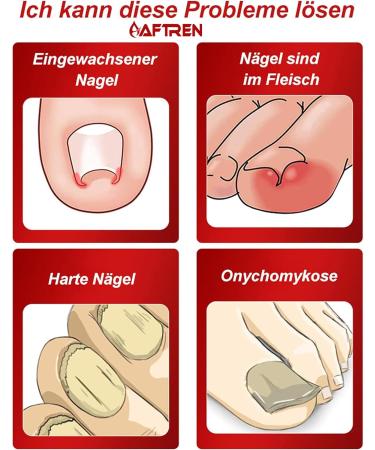 AFTREN Nail Clippers Cuticle Nippers Sharp Cuticle Scissors Smooth Cutting Stainless Steel Removing Excess Chapped Skin on Toes (Silver 5.5 Incn) 5.5 Incn Silver - Buy Online on GoSupps.com