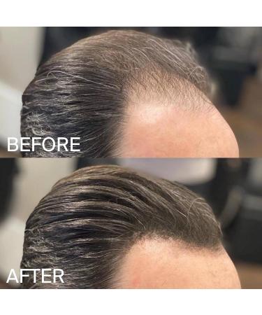 HLS Hair Fibers Medium Blonde | Hair Fiber Lightening Powder 25g Bottle | Instantly Increases Thickness with Concealer for Women and Men - Buy Online on GoSupps.com