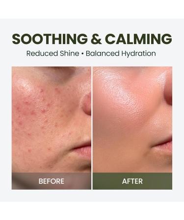 elravie HyCicaMue Defence Cream | Barrier Repair Moisturizer for Soothing Recovery | Cica Hyaluronic Acid Vegan Mucin | Calming Sensitive Skin Sebum Control Boosting Hydration | Korean Skin Care - Buy Online on GoSupps.com