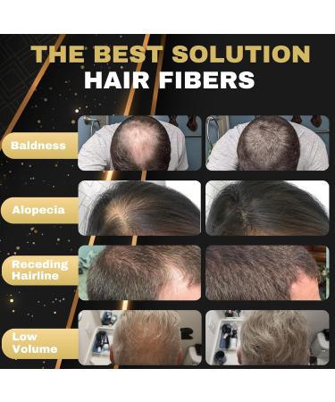 Salvathor Duran Hair Fibres - 2x25g Bottle - Hair Thickening Products for Men - Hair Fibres for Thinning Hair - Hair Thickener Full Kit for Men and Women - Hair Building Fibres Powder (Medium Brown) - Buy Online on GoSupps.com