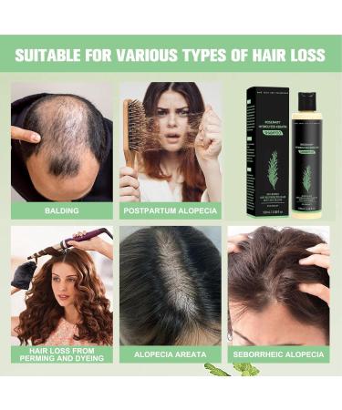 wiroouia Shampoo For Women100ml Moisturizing Volumizing Smoothing AntiDandruff Volume Moisturizing Shampoo for Damaged Dry Oily Fine Curly Hair Women and Men Daily Use - Buy Online on GoSupps.com
