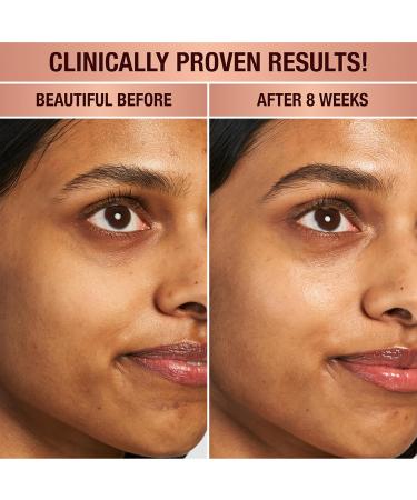 Charlotte Tilbury Magic Eye Rescue - Smoothing & Hydrating Under Eye Cream with Time-Released Retinol & Botanical Complex for Dark Circles Puffiness & Fine Lines - For Smoother Youthful Skin 0.5 Fl Oz (Pack of 1) - Buy Online on GoSupps.com