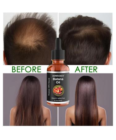 Organic Batana Oil for Hair Growth | 100% Pure | Promotes Hair Wellness for Men & Women | Enhances Radiance | 2.0 Oz - Buy Online on GoSupps.com