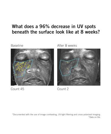 NEOVA SmartSkincare DNA Total Repair Serum 30 mL 1 fl. Oz. | Reduces Wrinkles Uneven Texture & Hyperpigmentation | Sun Damage Repair Serum - Buy Online on GoSupps.com