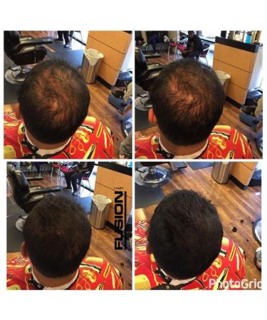 HAIR FUSION - Real Human Hair Fibers for Baldness & Thinning Hair - Root Touch Up, Volumizer - Unisex (Jet Black 1.05 oz) - Buy Online on GoSupps.com