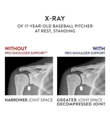 OPTP PRO Shoulder Support Pillow for Rotator Cuff Brace, Arm Sling, and Pain Relief - Standard - Buy Online on GoSupps.com