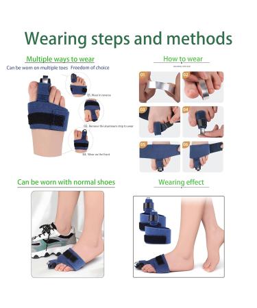 Hammer Toe Straightener Kit - Corrector & Splint for Men & Women | Compression Wrap & Toe Support for Curled & Broken Toes - Buy Online on GoSupps.com
