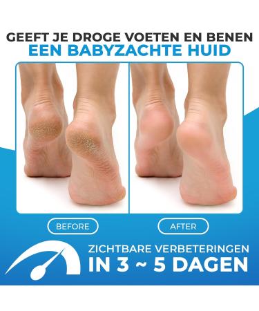 Imperial Feet Foot Balm - Moisturizing Cream with Honey & Aloe for Dry Feet Cracked Heels - 150 ml Glycerin & Ginseng Foot Care - Buy Online on GoSupps.com