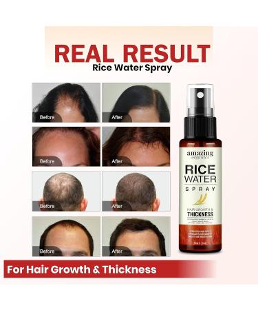 Rice Water Spray with Rosemary & Castor Oil - Hair Growth Treatment for Men & Women | Boost Volume & Reduce Hair Loss - Buy Online on GoSupps.com