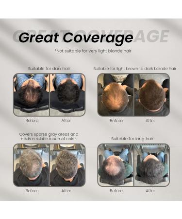 Batci Hair Concealer 50 ml Correcteur Calvitie & Cheveux Clairsem s Cr me de Camouflage Capillaire Densifiante Cuir Chevelu Effet Densit Imm diat - Buy Online on GoSupps.com