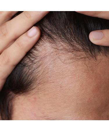 PHYTO Phytolium 4 Anti-Hair Loss Treatment - 12 X 3.5ml - Buy Online on GoSupps.com