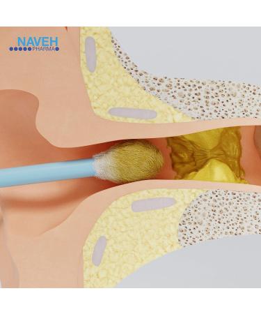 Naveh Pharma CleanEars Baby Earwax Removal Spray + Otic Guard Ear Infection Spray - 1 Fl Oz Each - Buy Online on GoSupps.com