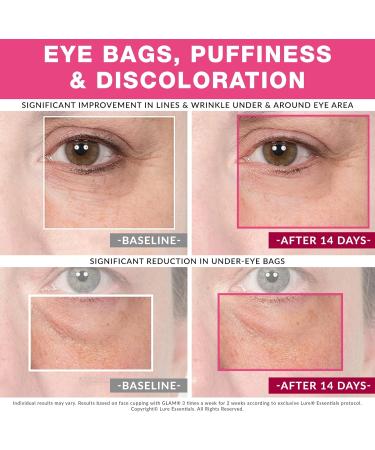 LURE GLAM Face Cupping Facial Set - Lift Firm Sculpt Plump with FREE Brush - Anti-Aging - Instant Lines and Wrinkles Filler - Buy Online on GoSupps.com